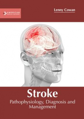 Stroke: Pathophysiology, Diagnosis and Management