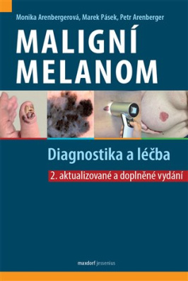 Maligní melanom - Diagnostika a léčba 