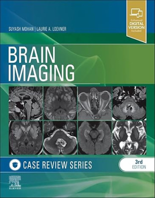 Brain Imaging: Case Review Series 