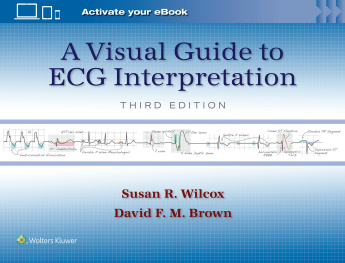 Visual Guide to ECG Interpretation